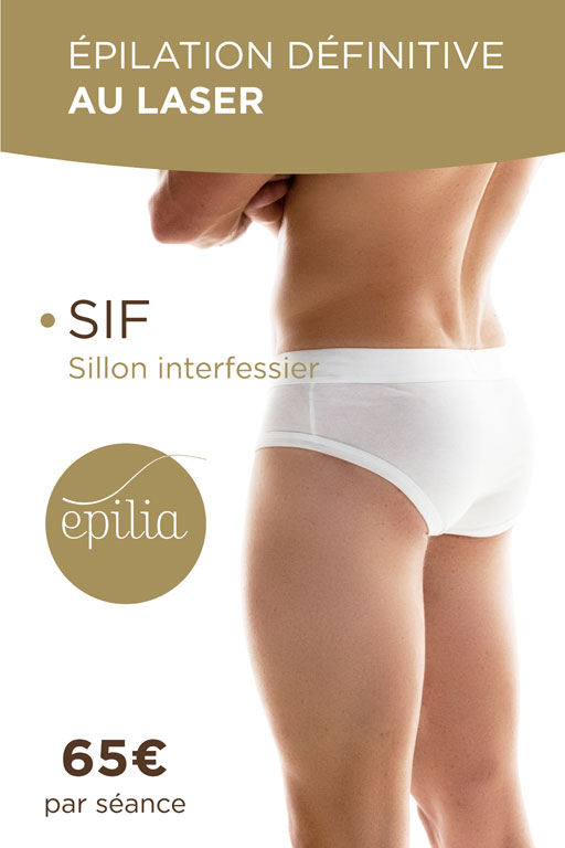 epilation-laser-sif-homme-charleroi-mob